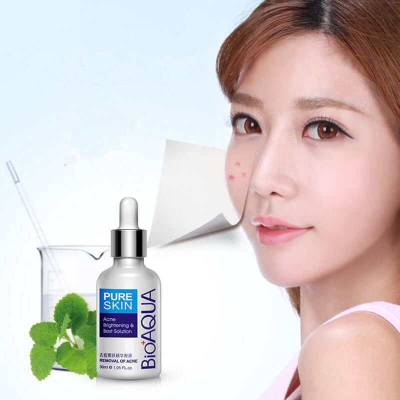 Gentle Acne Rejuvenation Essence Liquid